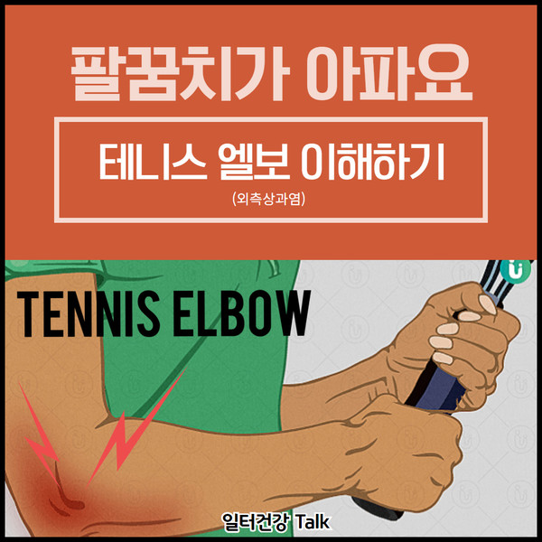 해운동팔꿈치통증 겪고 계셨다면 5